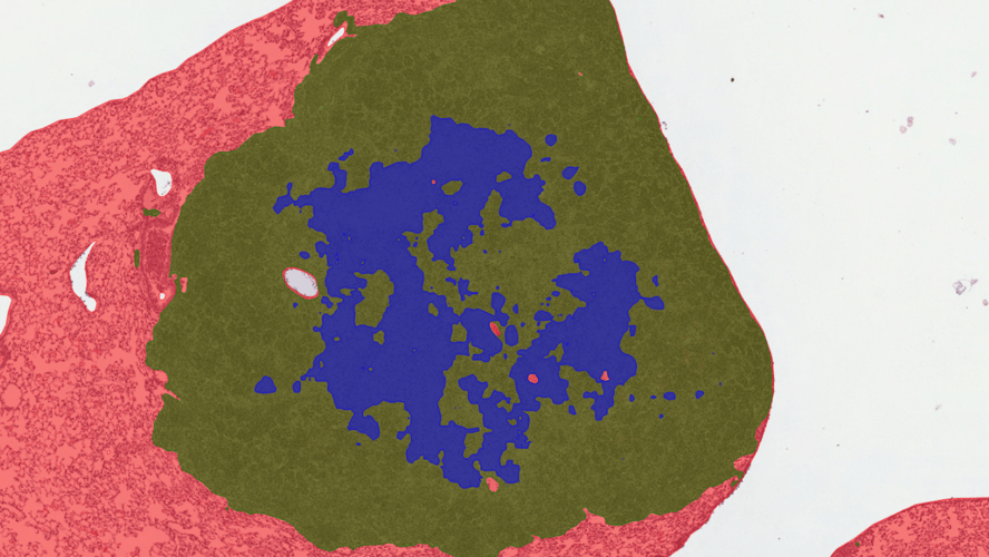 Tufts University case study: enhancing tuberculosis research with AI