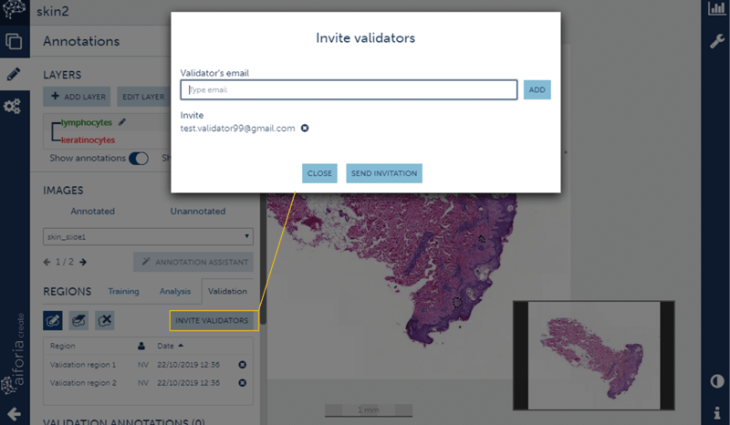 Aiforia Create external validation-1-1