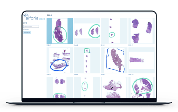 remote pathology AI platform