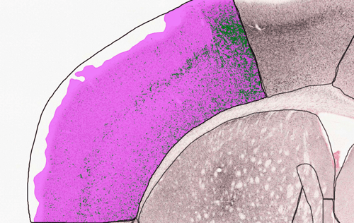 AlphaSynuclein after AI detection
