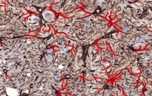Astrocyte after AI detection