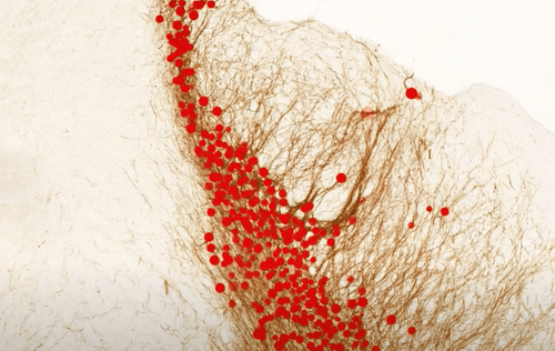 Neuron quantification after AI detection
