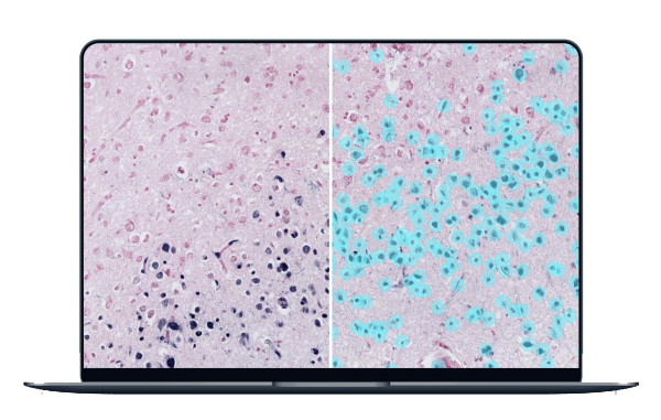 artificial intelligence image analysis