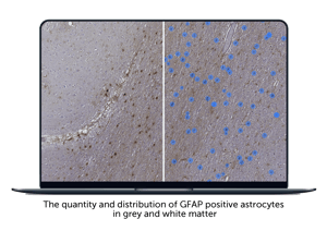quantity and distribution of GFAP positive astrocytes