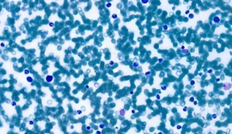 leonie-satf-project-bone-marrow-detection-2