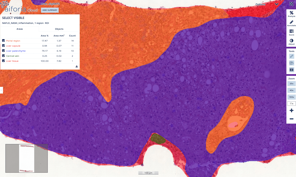 Aiforia® Create features: object detection, semantic and instance ...