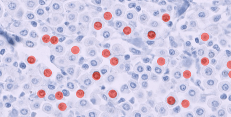 veterinary-pathology-cutaneous-mast-cell-tumor-ki-67-1