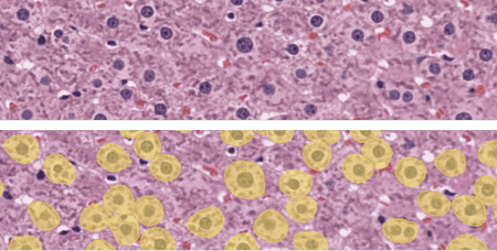 veterinary-pathology-hepatocyte-hypertrophy