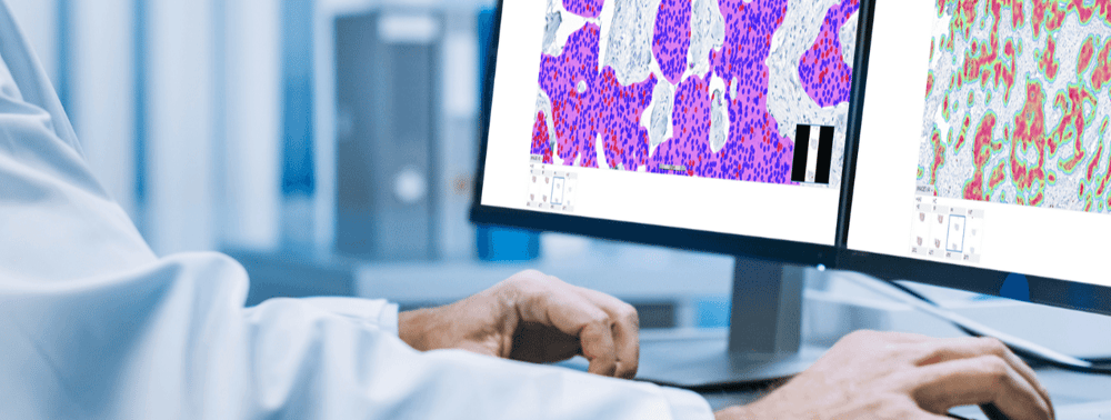 Breast cancer suite-1