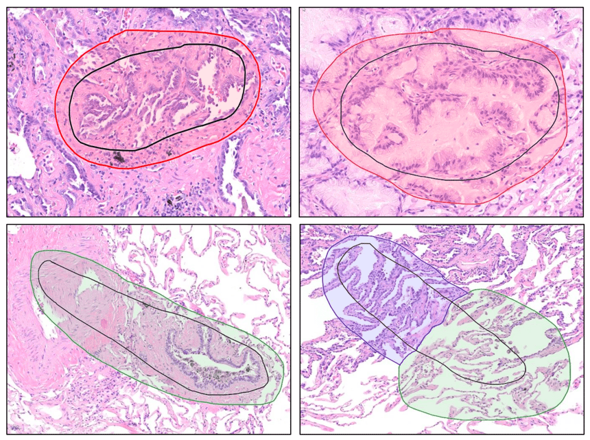 case-study-dr-boland-et-al-model-creation