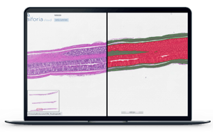 DSS colitis_CRL_laptop