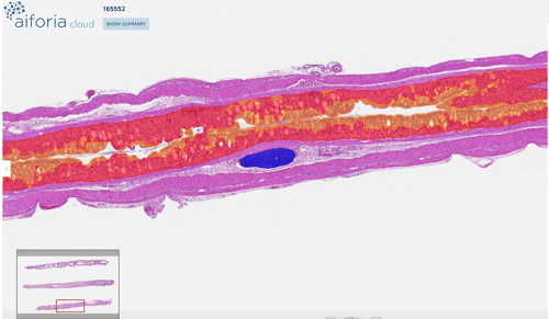 DSS-colitis-1-after