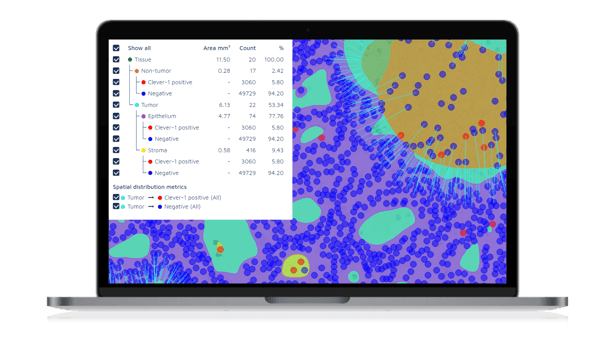 AI performs spatial analysis