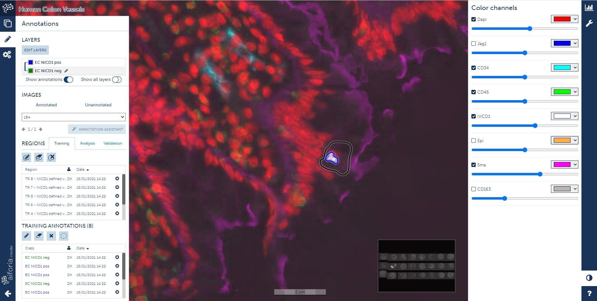 Human Colon Multichannel 1