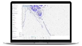 Ki67 hotspot 1 clinical_laptop