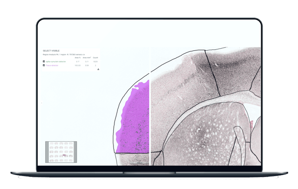 alpha-synuclein AI assisted pathology