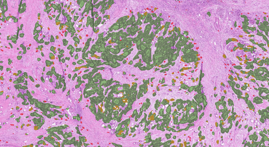 Using prognostic AI models in pathology: case colorectal cancer