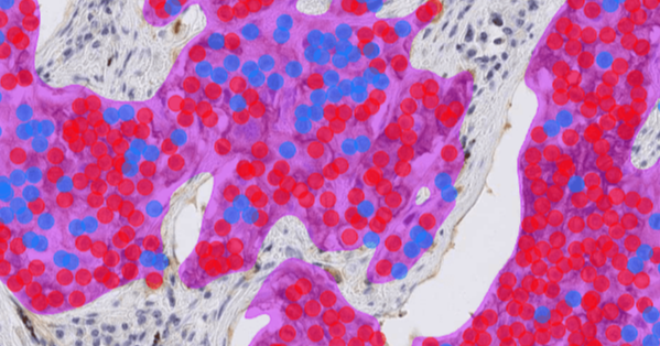 Lung_PDL1_carousel-size