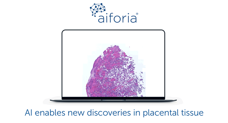 placental tissue AI discoveries