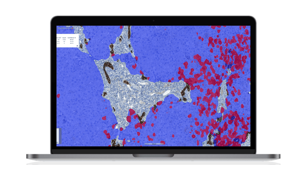 Conference AASLD The Liver Meeting 2022
