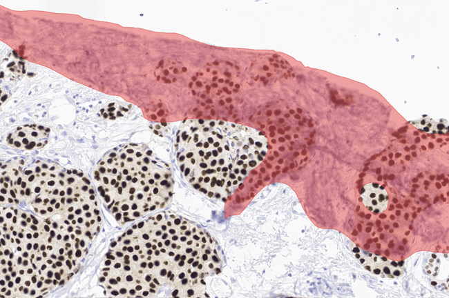 Aiforia® Quality Control IHC