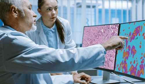 Aiforia signs a licensing agreement with the Mayo Clinic for an AI model that improves prediction of colorectal cancer recurrence