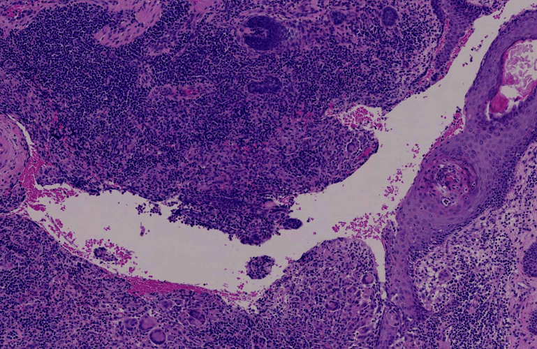 Aiforia secures U.S. patent for high-speed AI training tool in medical image analysis