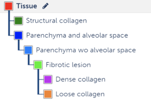 lung fibrosis features analysis classes