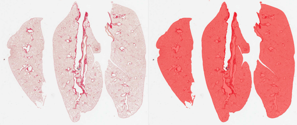 Automated image analysis of lung tissue