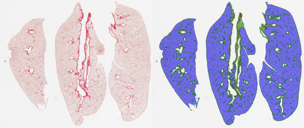Automated image analysis of lung parenchyma and collagen