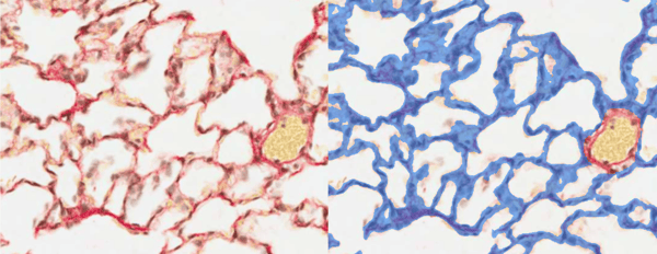 Automated image analysis of alveolar space