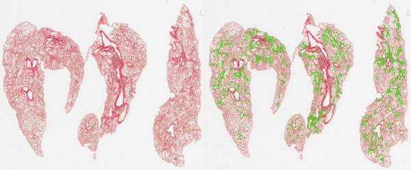 image analysis of poorly inflated lung tissue