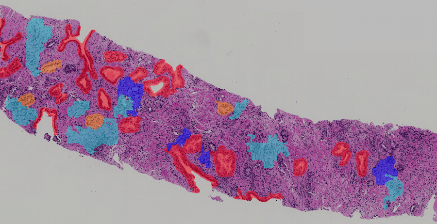 Benefits of AI and digital pathology to the clinical lab