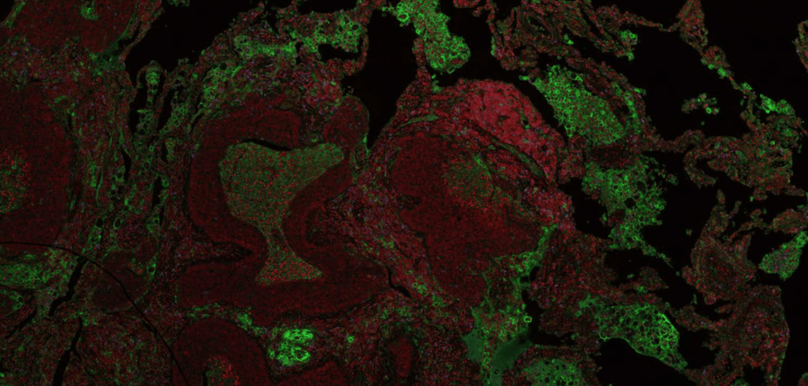 The impact of digital pathology on immuno-oncology