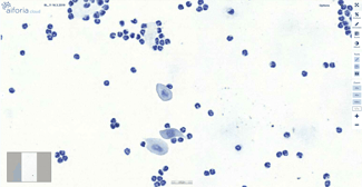 Strauss reproductive disease analysis results