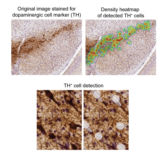 TH cell detection example_1-1