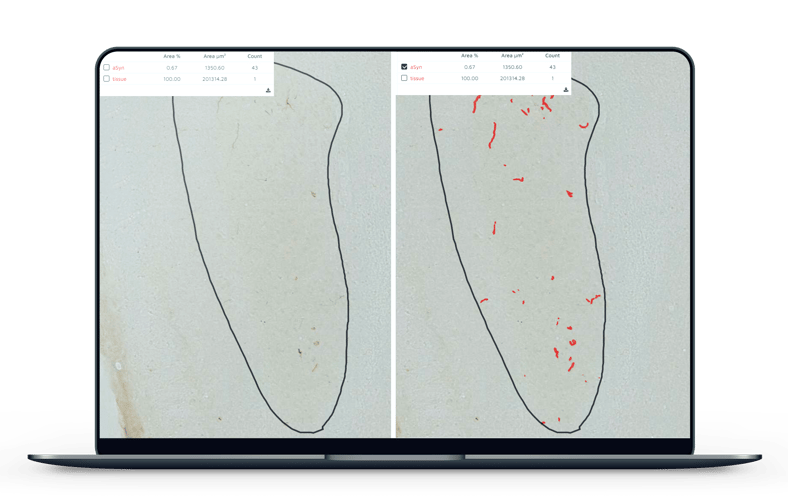 Van Andel Institute case study: quantitative assessment of alpha-synuclein immunoreactivity with AI