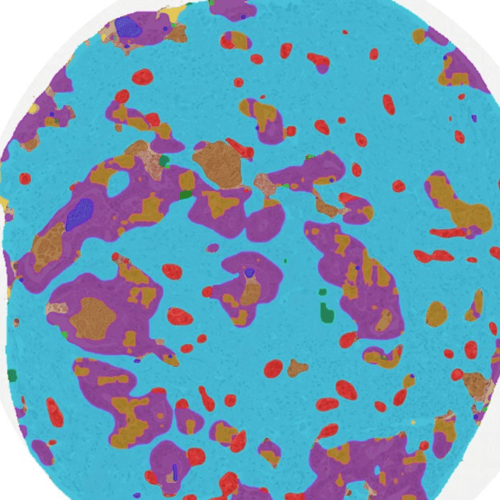 AI Powered Quantitative Pathology in Clinical and Preclinical Studies