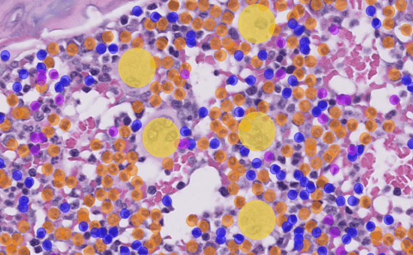 How can AI-assisted image analysis boost productivity in preclinical research, including GLP?