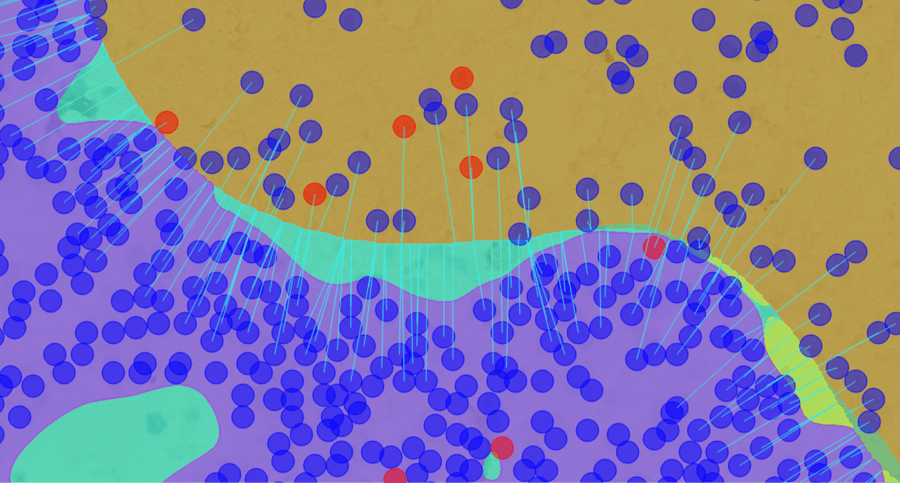 Faron Pharmaceuticals case study: using AI to perform spatial analysis in cancer drug development