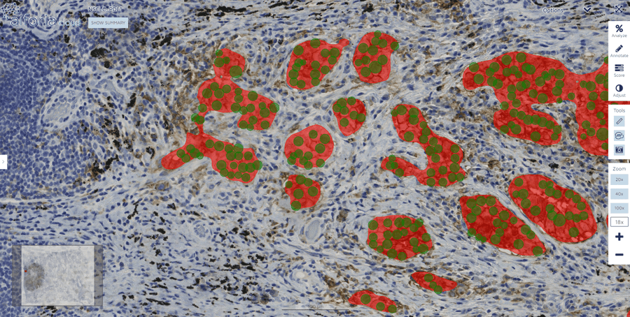 Case study: validation of PD-L1 AI model in six labs in the Netherlands