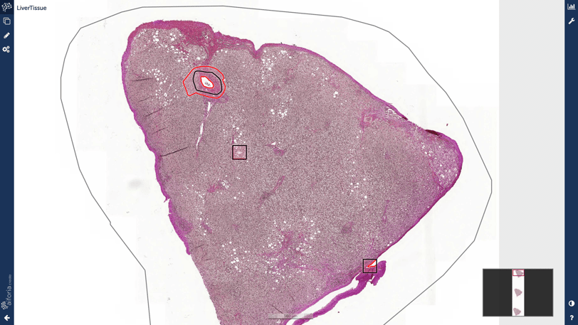 liver-annotations