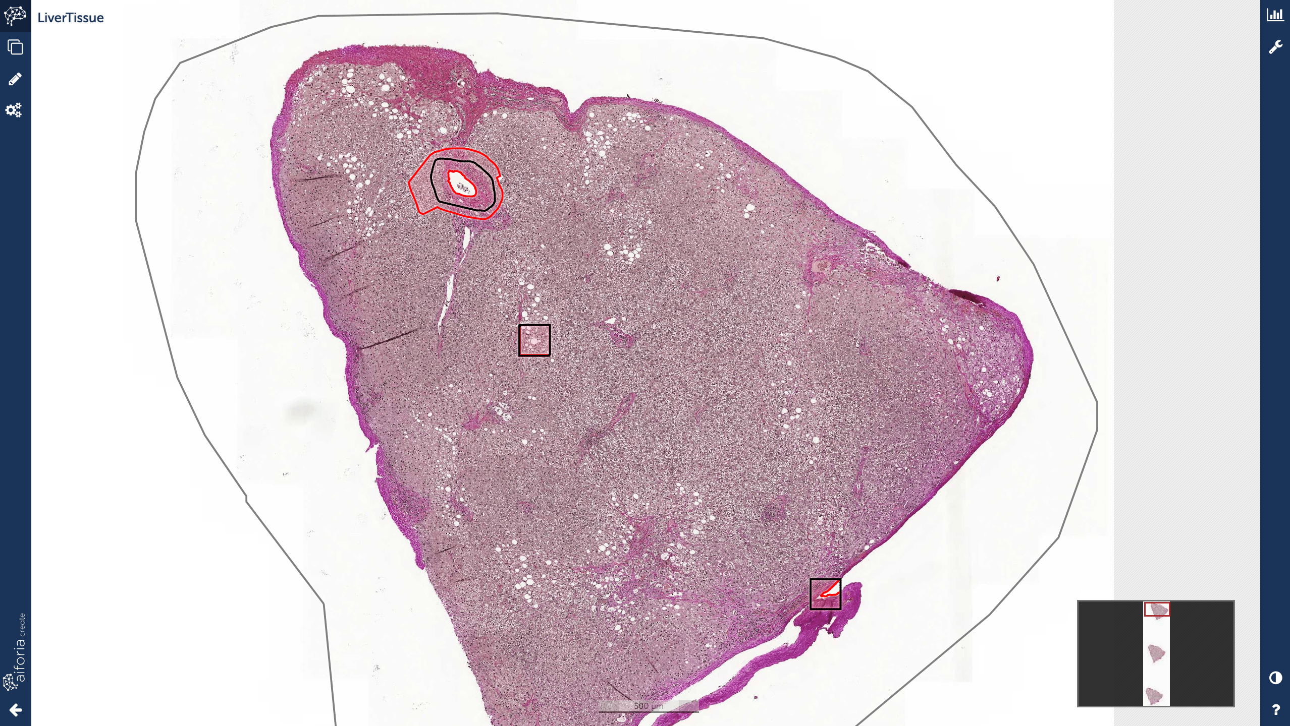 liver-annotations