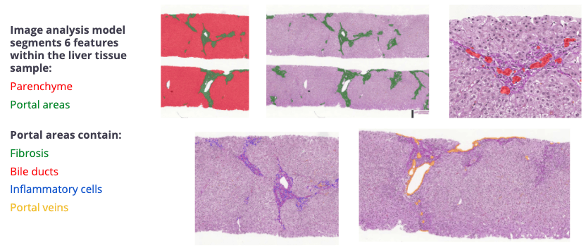 liver-segmentation