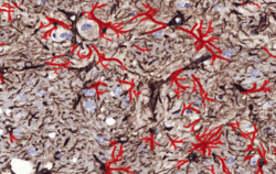 Astrocyte after