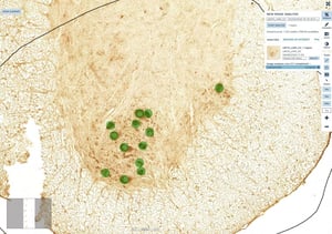 chat staining image for aiforia1 (1)