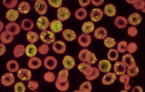 Coronavirus before AI image analysis