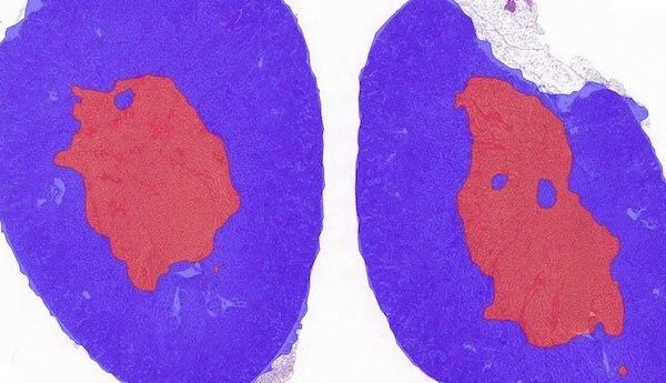kidney_cortex_medulla_after