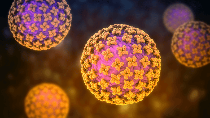 Case study: using AI to identify and research orthohantavirus infections