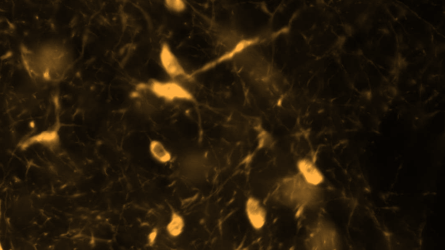 Case study: the use of AI in Parkinson’s disease research